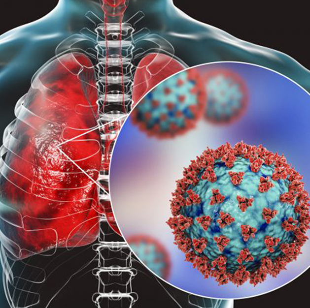Respiratory Infections & ARDS