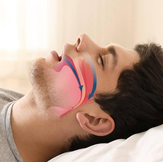 Sleep Apnoea & Sleep Disorders